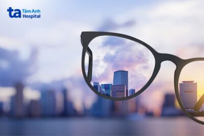 Dấu hiệu nhận biết cận thị