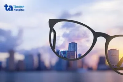 Dấu hiệu nhận biết cận thị