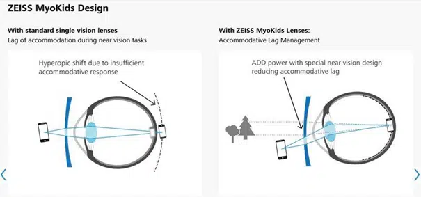trong kinh zeiss myokids myo kids 3