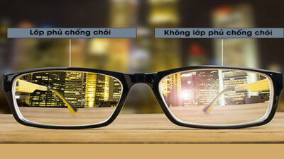 trong kinh chong choi 2