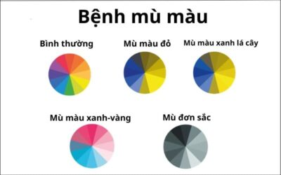kiem tra mu mau 6 3