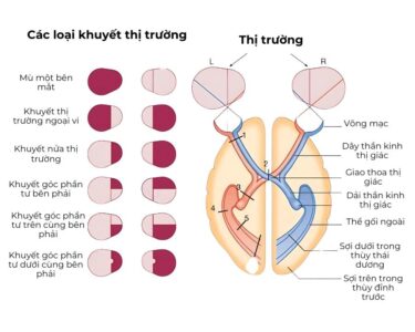 khuyet thi truong 1 1