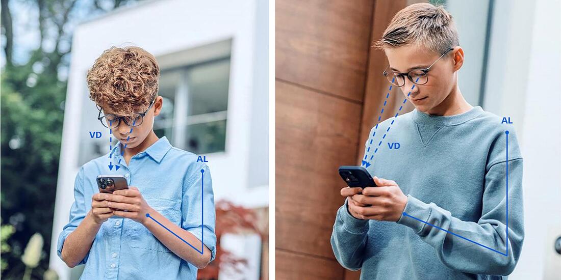 pr zeiss smartlife young anatomy distances orig 1