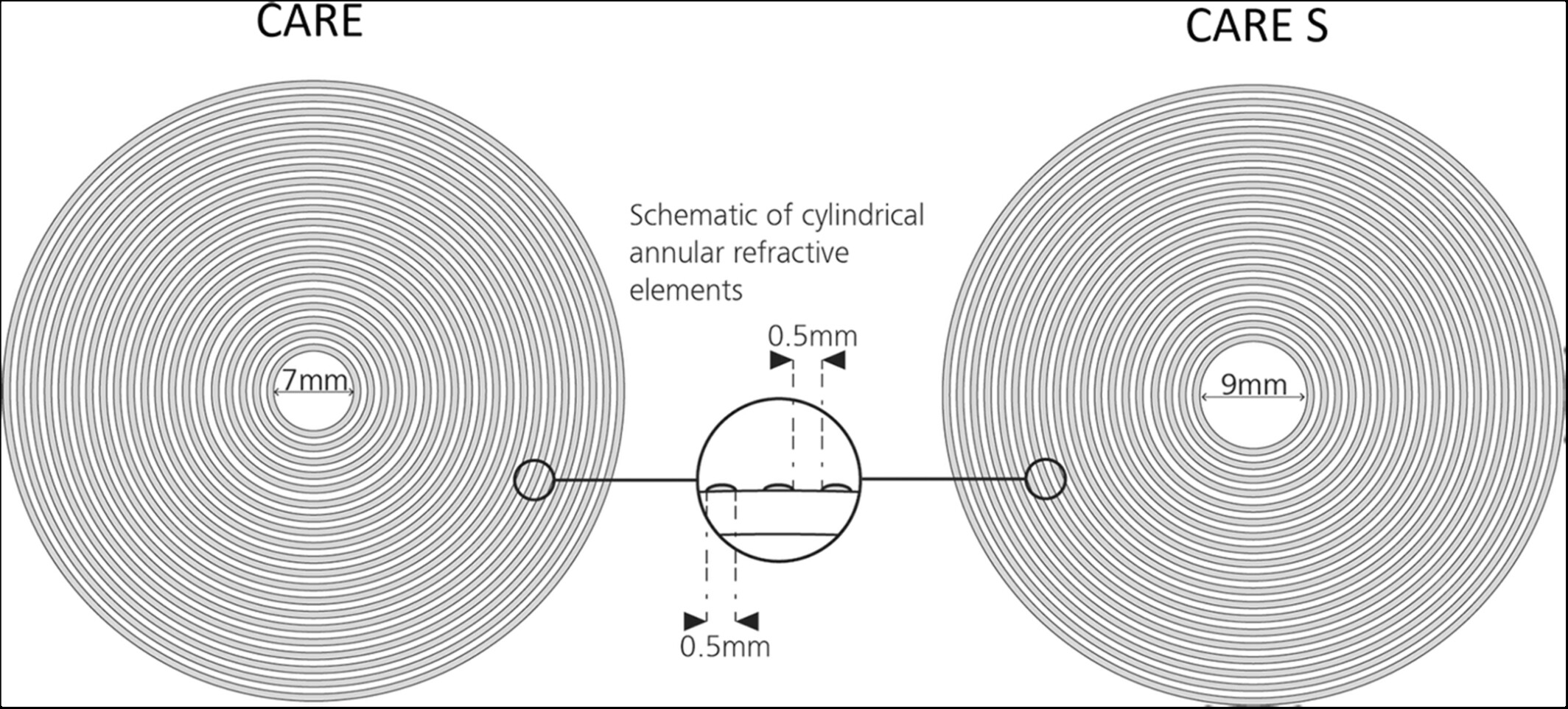 Zeiss C.A.R.E technology